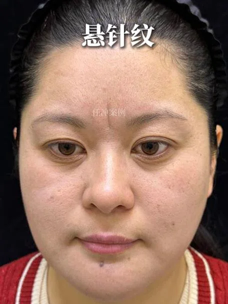 蛇形人面相-蛇形面相独特
