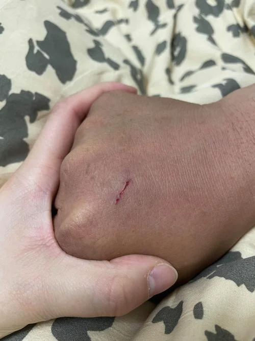 梦到被小狗咬到手腕_1