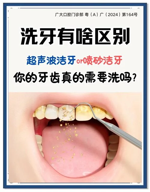 超声洗牙原理_2