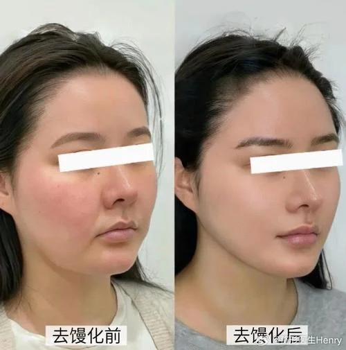 填充是什么意思_1