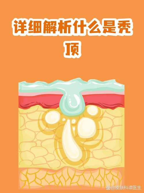梦见自己秃顶预示着什么-秃顶梦境预示含义