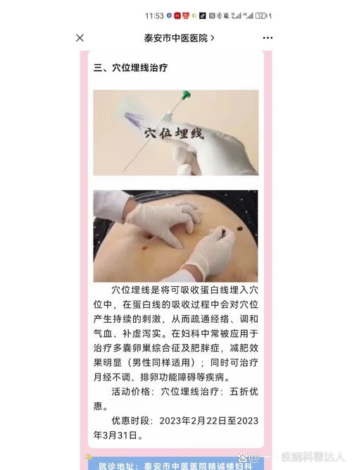 埋线减肥在哪里学-埋线减肥去哪里