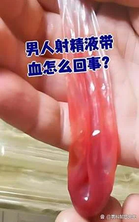 射精是带血是什么原因_1