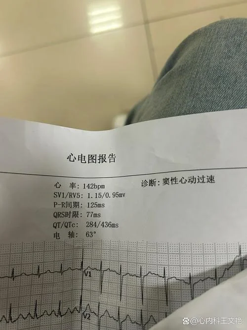 心肌5项是检查什么_2