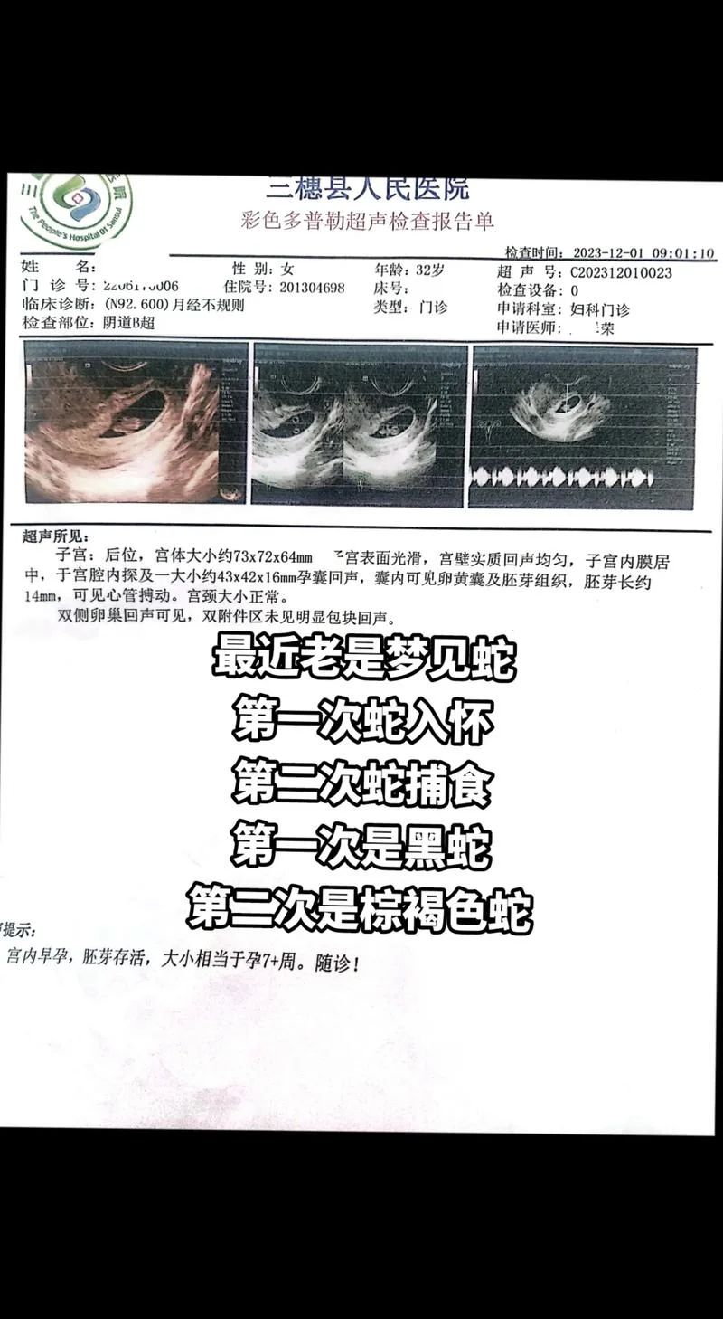孕妇梦见小蛇是女儿-孕妇梦蛇预示得女