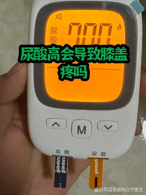 ua尿酸偏高是什么意思_1