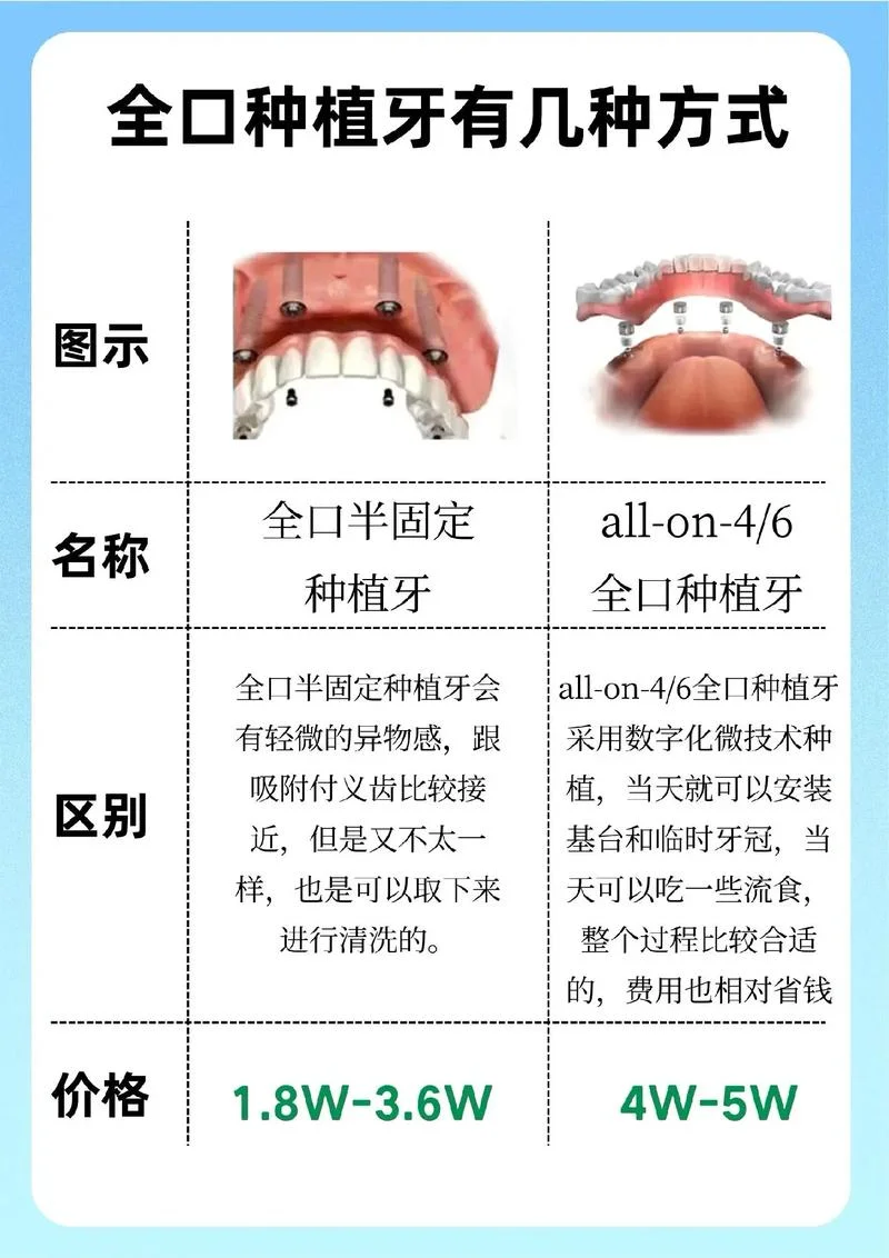 全口牙石2度什么意思_2