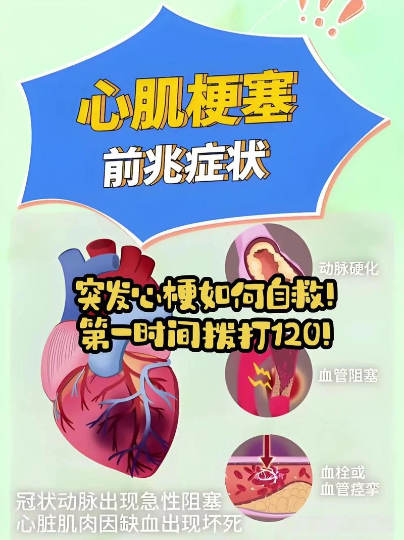 心梗如何查_2