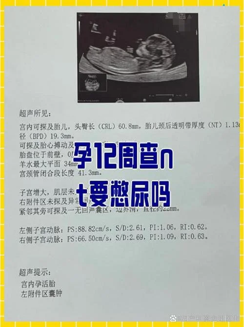 怀孕12周做nt是检查什么的_1