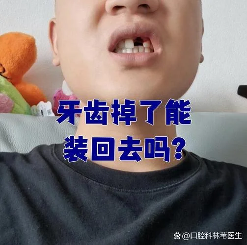 男人梦到牙齿掉了_2