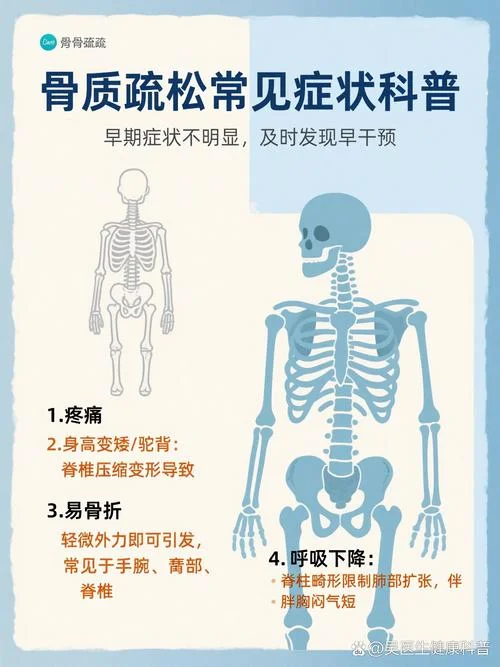 什么是骨质疏松疼痛_2