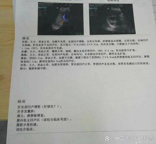 什么是肝实质回声密集_2