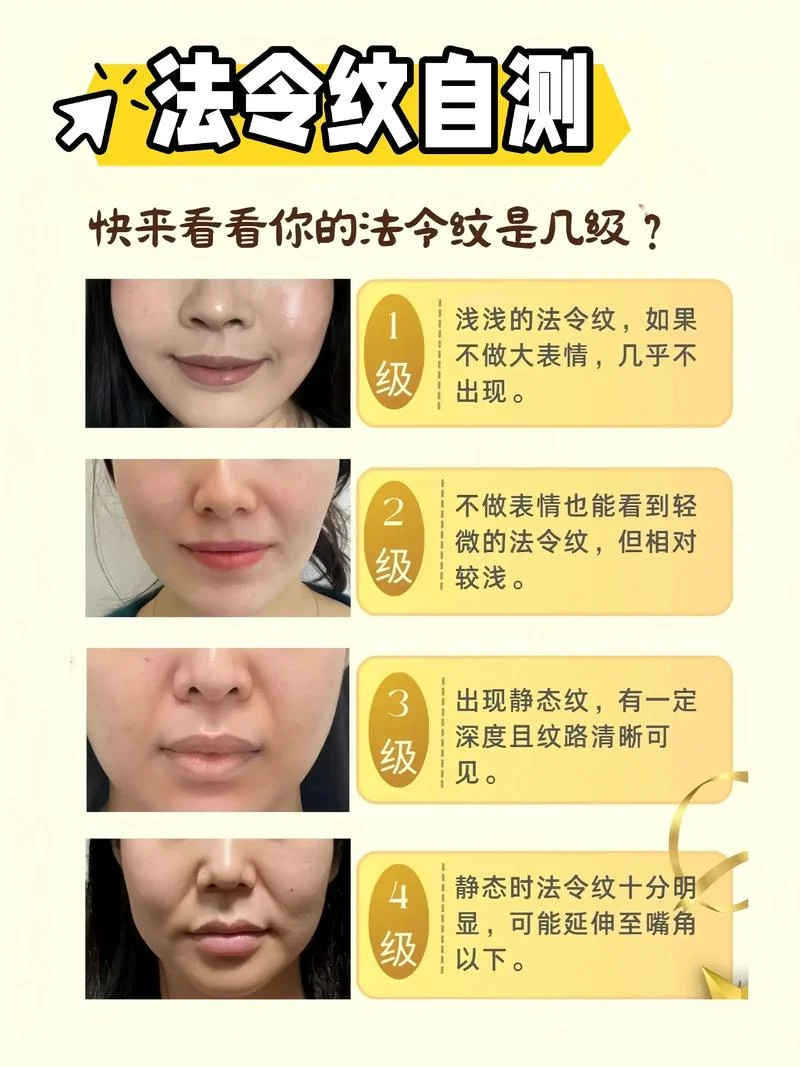 法令纹对运势的影响-法令纹影响运势