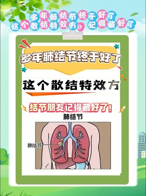 如何查肺结节_1