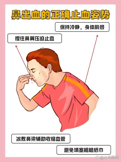儿童流鼻血怎么办最简单方法-儿童流鼻血最简自救法