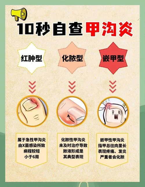 刚出生宝宝甲沟炎怎么办_1
