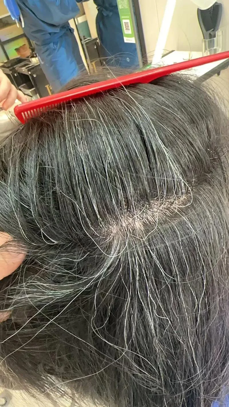 梦到很多白头发-“梦到白发”关键词