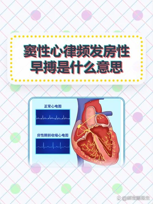 心房下部心律什么意思_1