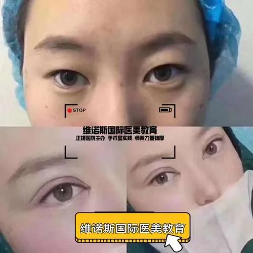 成都哪里学微整形好_1