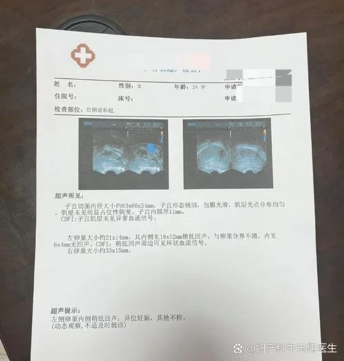 什么是宫外孕宫外孕一般多久能发现_1