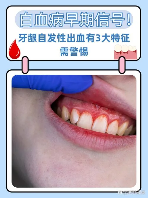 梦到自己的牙掉了流血_1