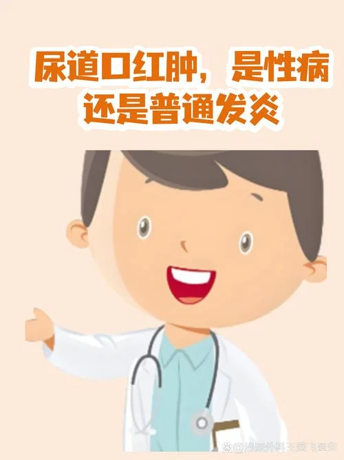 尿道炎总反复怎么办-尿道炎反复怎么办