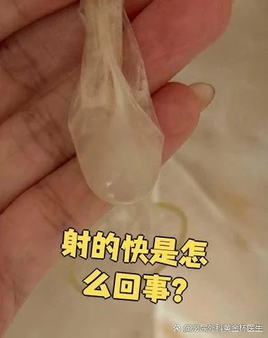 射那么快怎么办-射那么快怎么办
