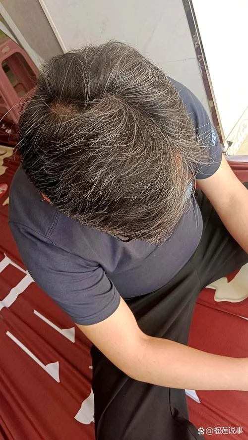梦见自己满头白头发_2