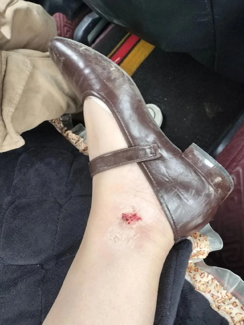 梦见腿流血不止-梦见腿流血不止