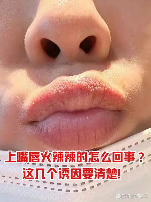 嘴唇上面叫什么-嘴唇上方名称