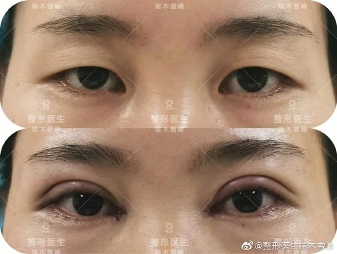 医生整形的感悟-医生整形感悟