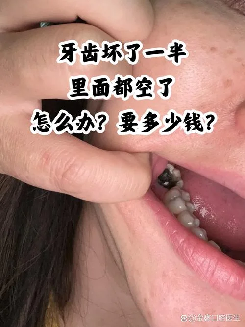 坏牙齿叫什么牙_1
