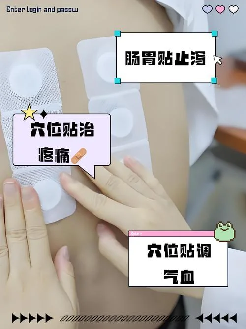 什么是穴位贴敷_1