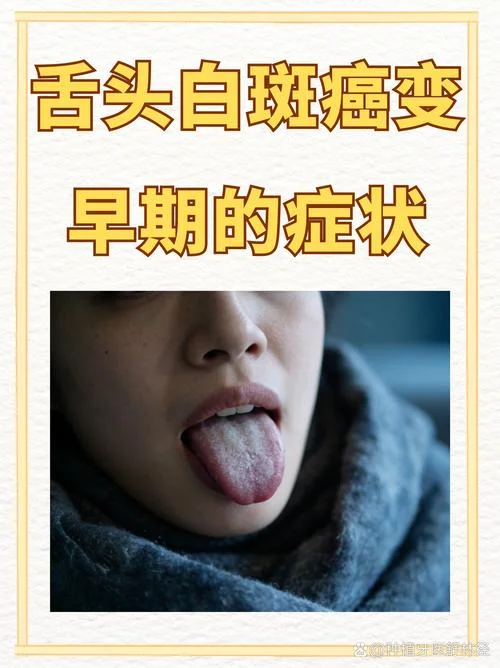 舌苔发白是得了什么病_1