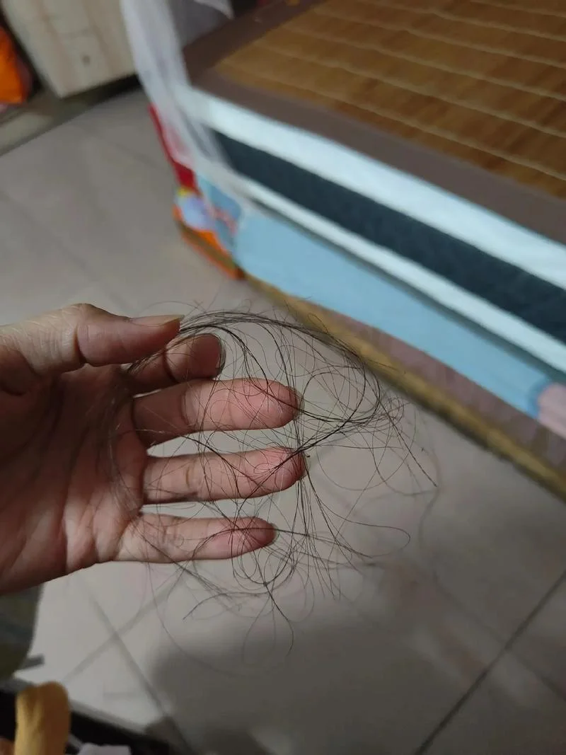 梦见自己的头发一抓就掉一撮_2