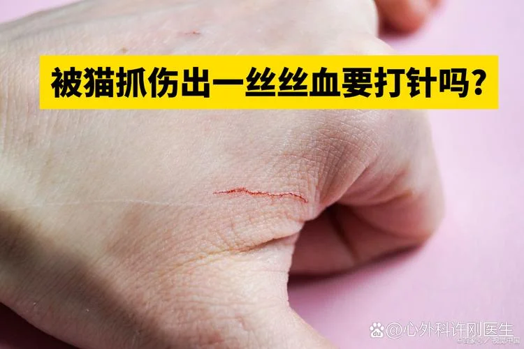 梦见被猫抓伤还出血了_2