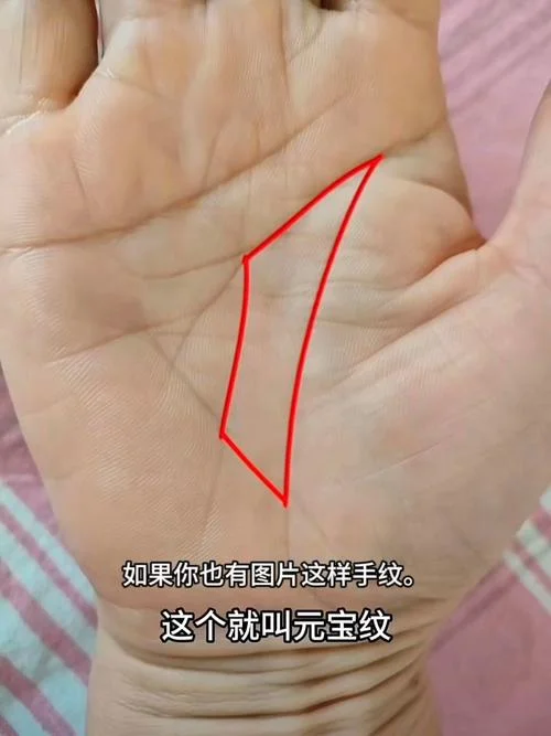 手相大富大贵痣_1