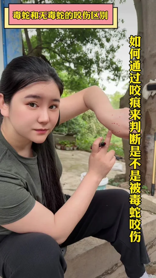 梦见蛇咬自己出血是什么兆头女人-女人梦见蛇咬出血