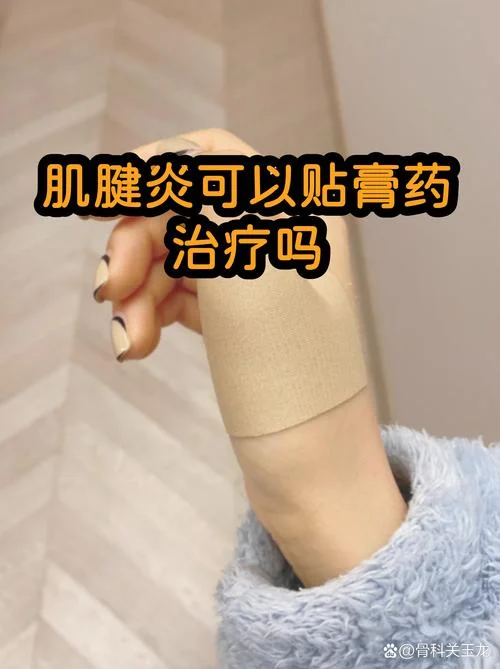 腱鞘炎贴膏药十大品牌-腱鞘炎膏药十大品牌