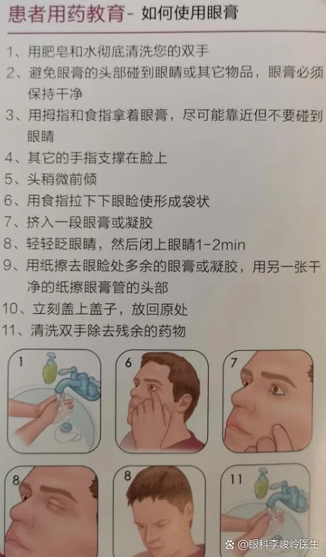 氧氟沙星眼膏怎么用-氧氟沙星眼膏使用法