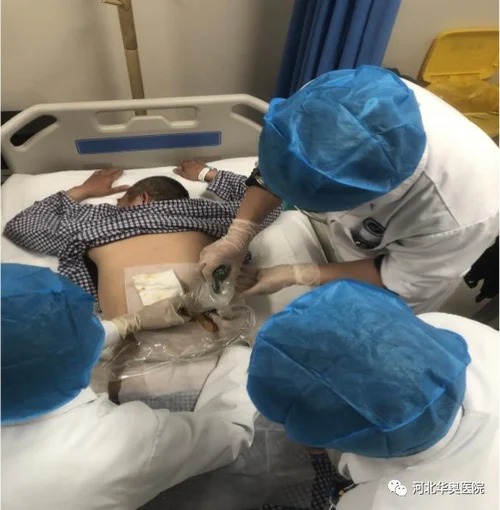 什么是肾穿刺检查_2