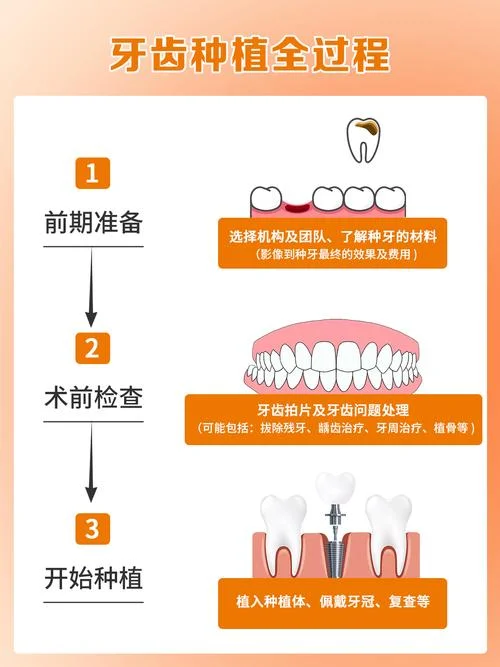 种植牙有什么要求吗_1