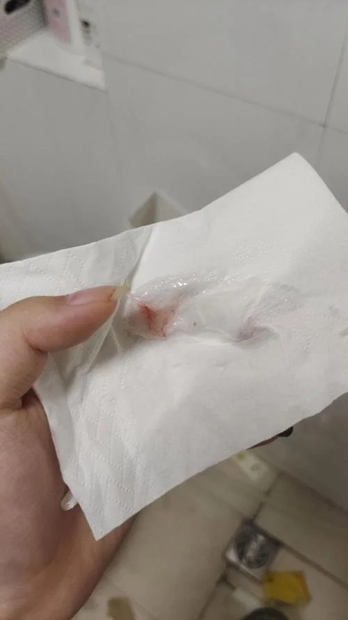 梦见自己得绝症吐血块-梦吐血块患绝症