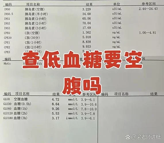 如何查是不是低血糖-查低血糖确认法