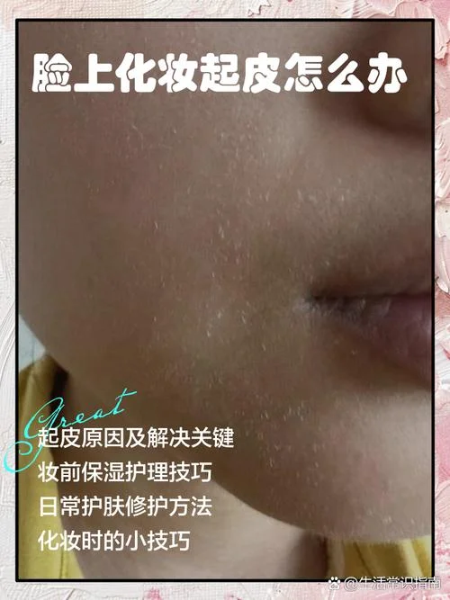 化妆品过敏怎么办脸部怎么办-过敏脸部如何处理