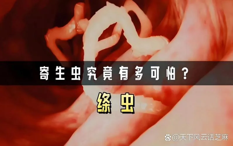 梦见寄生虫从体内出来-梦寄生虫出体