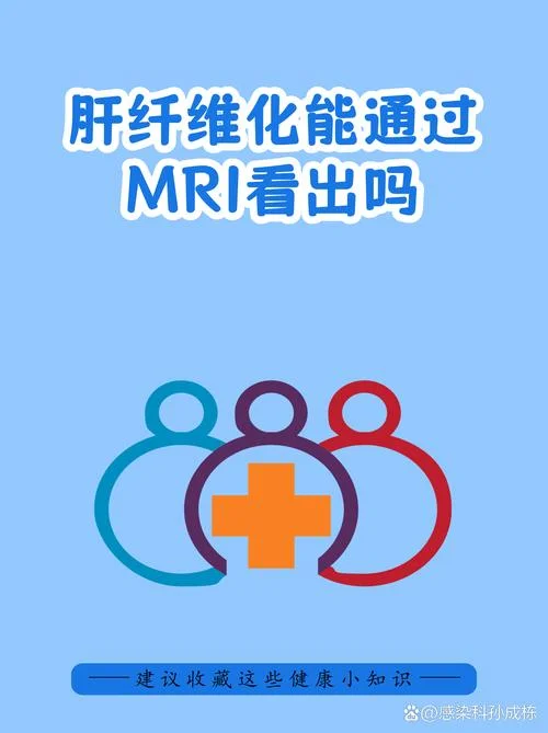 肝纤维化4项检查原理_2