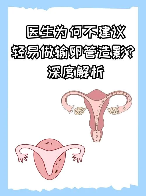 如何查输卵管憩室_1