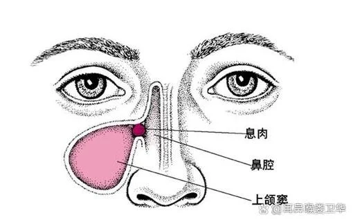 两个鼻孔间的肉叫什么_1