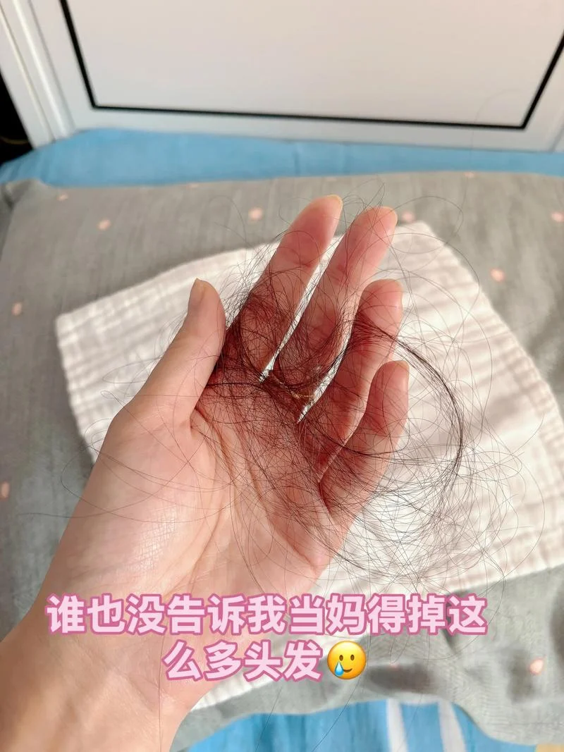 梦见头发掉了很多大哭_2